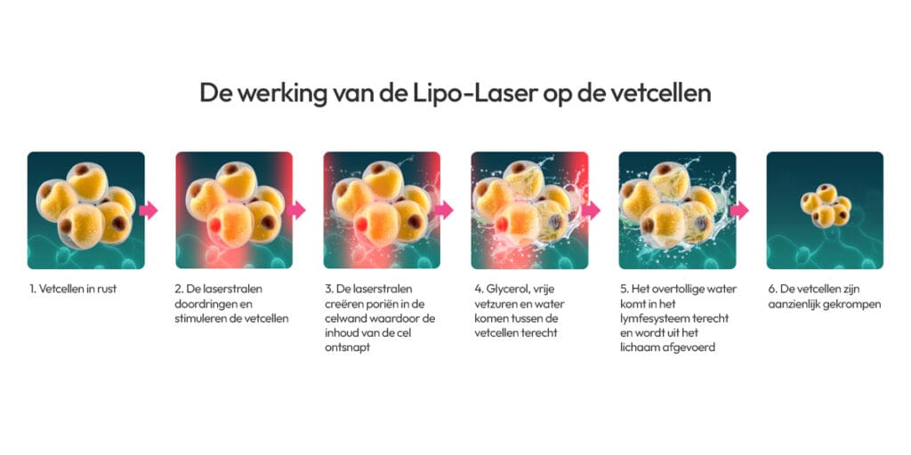 Detoxbody maakt gebruik van de Lipo-Laser. Uitleg over de werking ervan. 